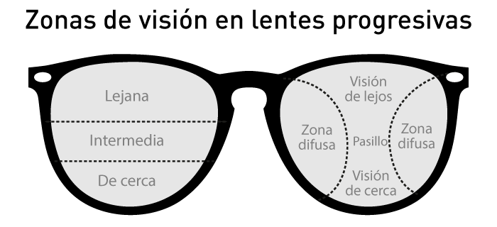 visión en progresivos
